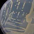 @A. Lathus / INRAE (souche de Curtobacterium flaccumfaciens pv flaccumfaciens, pathogène de haricot, sur boite de Petri)